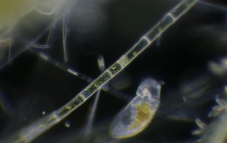 Zygnema Algae and a Rotifier
