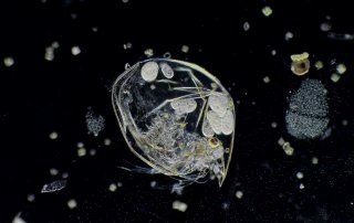 Paramecia inside a Water Flea