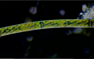 Zygnema Algae